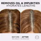 L’oréal Paris Elseve Hyaluron Pure Hair Balm for Oily Scalp and Dry Ends 200 Ml Фото num