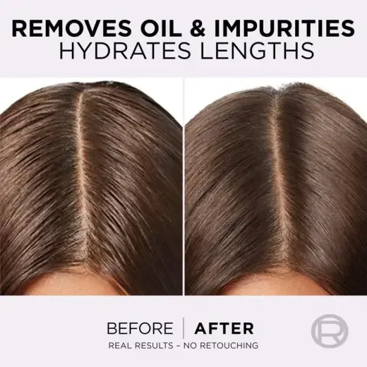 L’oréal Paris Elseve Hyaluron Pure Hair Balm for Oily Scalp and Dry Ends 300 Ml Фото num