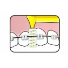 TePe Interstitial Brushes - 6 Pcs Foto 3