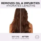 L’oréal Paris Elseve Hyaluron Pure Hair Balm for Oily Scalp and Dry Ends 200 Ml Фото num