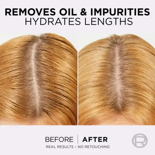 L’oréal Paris Elseve Hyaluron Pure Hair Balm for Oily Scalp and Dry Ends 200 Ml Фото num