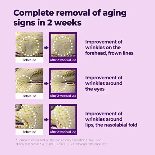 Some by Mi Skincare Retinol Intense Triple Action Eye Cream 30Ml Foto 11