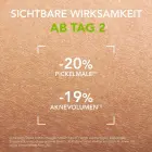 Bioderma Sebium Kerato+ Gel-Cream 30ml Foto 6