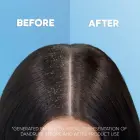 Head & Shoulders Extra Volume Anti-dandruff Shampoo 400 Ml Foto 3