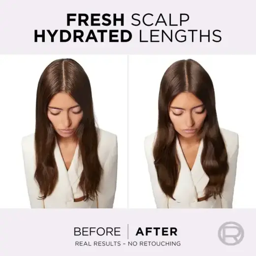 L’oréal Paris Elseve Hyaluron Pure Hair Balm for Oily Scalp and Dry Ends 200 Ml Фото num